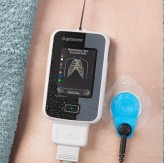Getemed und Deutsche Telekom haben zusammen mit Krankenhäusern und niedergelassenen Ärzten ein Projekt für Telemedzin in Brandenburg gestartet. Es soll durch permanente Überwachung Herzkranken helfen.