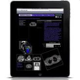 Die à la Apple gestylte Oberfläche von RadSpeech: Für Radiologen ein neues Dialogsystem für ihre Arbeit mit den Patienten.